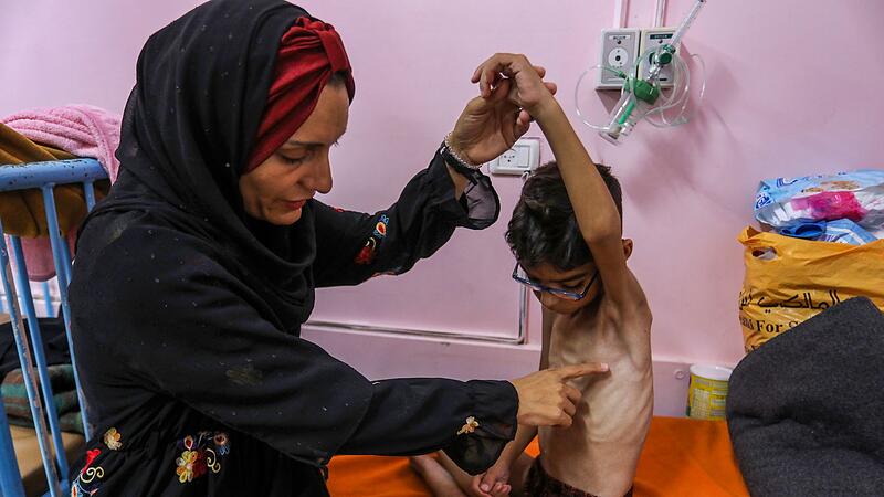 Nahost-Konflikt - Unterernährte palästinensische Kinder