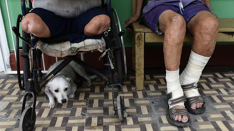 Leprapatienten Leprapatienten