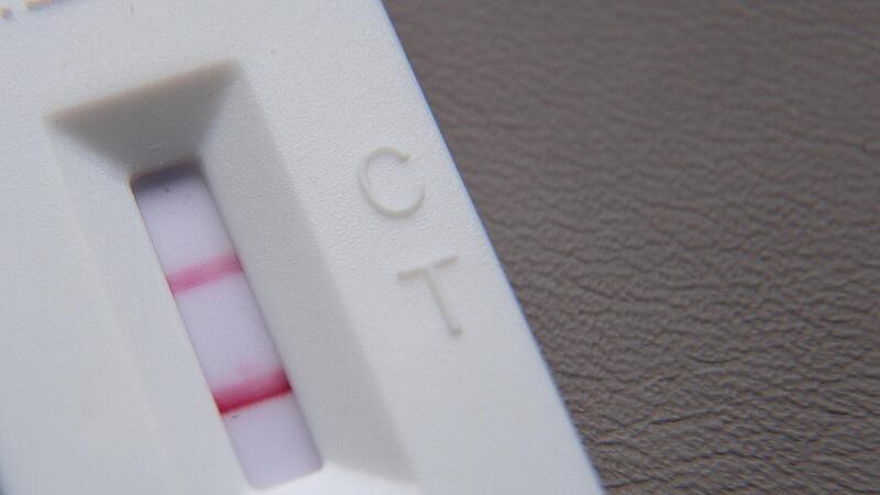 125 neue, positive PCR-Tests hat das Landratsamt Kulmbach am Dienstag registriert.