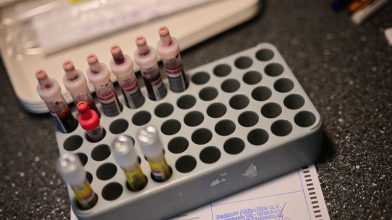 HIV-Test