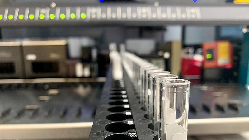 Ein Blick ins Labor der Sozialstiftung Bamberg an der Buger Stra&szlig;e.