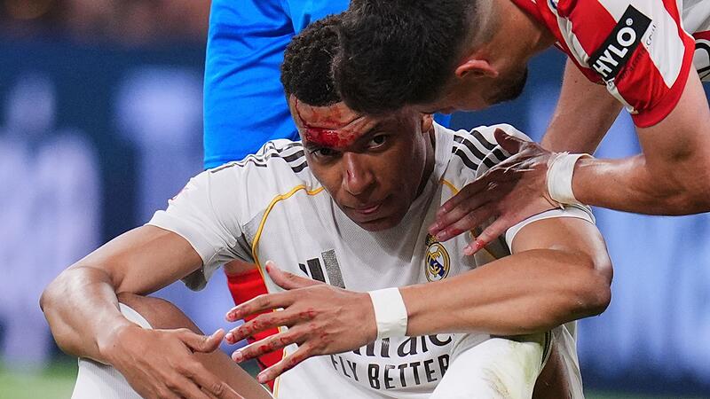 Real Madrid - FC Girona Real Madrid - FC Girona