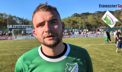 Platzwunde &uuml;ber dem Auge: Rico Nassel spielte im Pokalfinale fast 80 Minuten mit Turban.