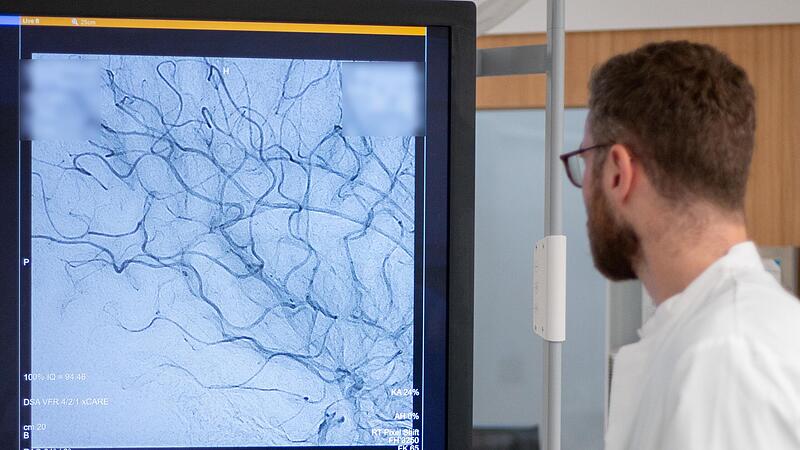 Zu Vortragsveranstaltungen zum Thema Schlaganfall lädt das Klinikum Kulmbach ein. Zu Vortragsveranstaltungen zum Thema Schlaganfall lädt das Klinikum Kulmbach ein.