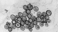 Hantavirus Hantavirus