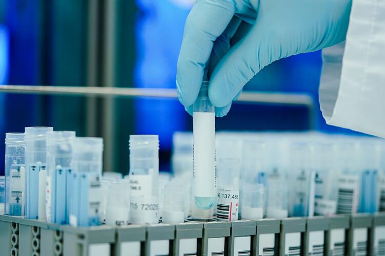 Die PCR-Tests werden knapp