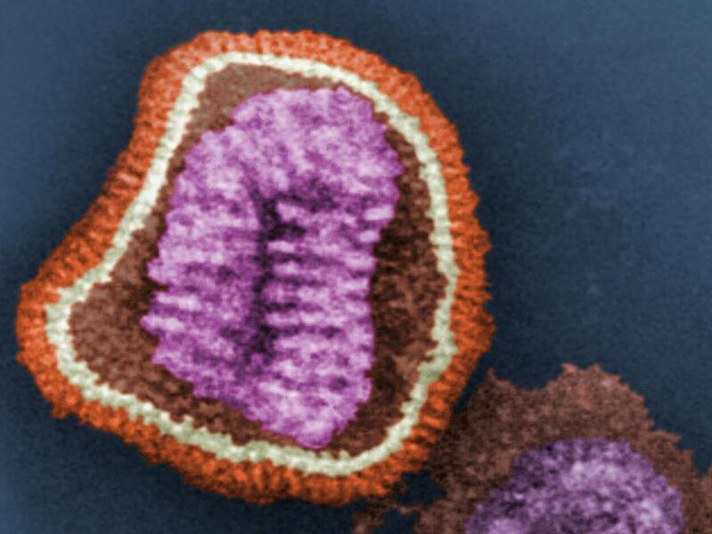 Was hier so bunt eingefärbt wurde und schön ausieht, ist ein gefährlicher Influenza-Virus