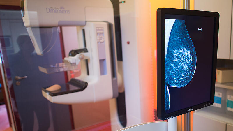 Eine Mammografie-Untersuchung: Die Methode wird zur Fr&uuml;herkennung von Brustkrebs eingesetzt.