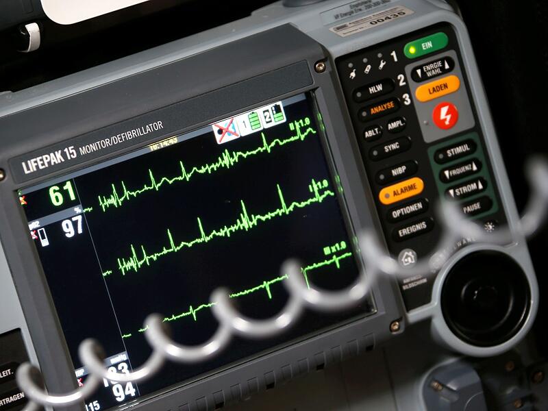 Sinusrhytmus eines Herzens ist auf einem EKG zu sehen