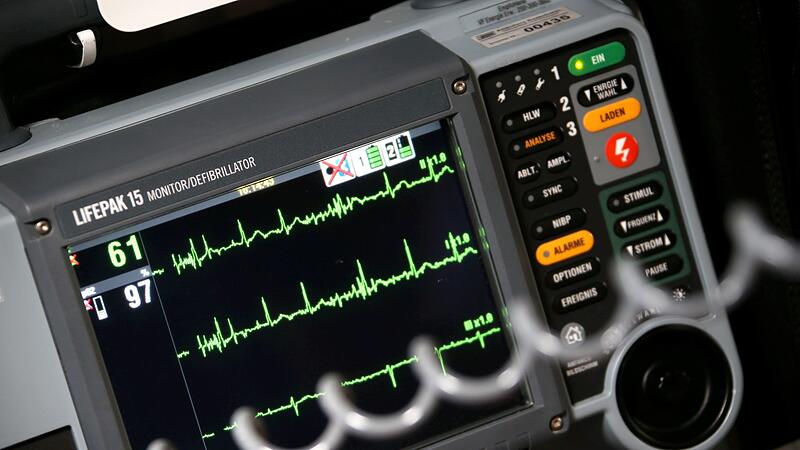 Sinusrhytmus eines Herzens ist auf einem EKG zu sehen