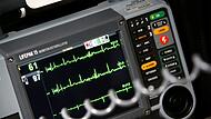 Sinusrhytmus eines Herzens ist auf einem EKG zu sehen