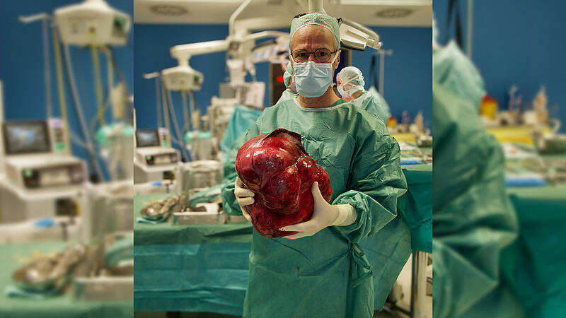 Vier Stunden hat die Operation gedauert, bei der Dr. Jochen Thies vom Klinikum Bamberg diesen riesigen Lebertumor aus einer Patientin entfernt hat.