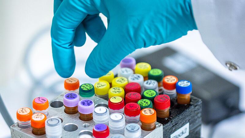 Lebensmitteluntersuchungen im Landeslabor Lebensmitteluntersuchungen im Landeslabor