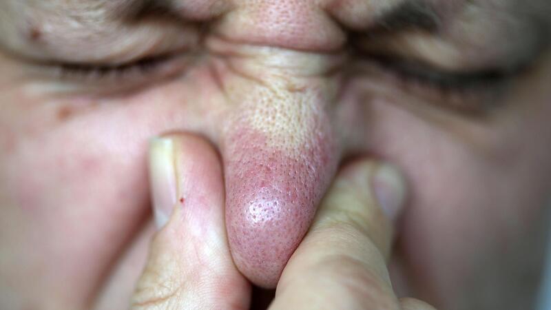 In der Gesch&auml;ftsstelle einer Versicherung in Coburg kam es zu einem &uuml;bel riechenden Zwischenfall.