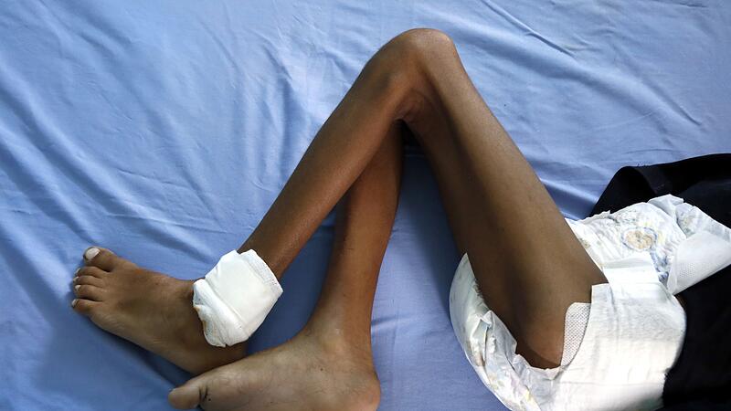 Hungersnot im Jemen Hungersnot im Jemen