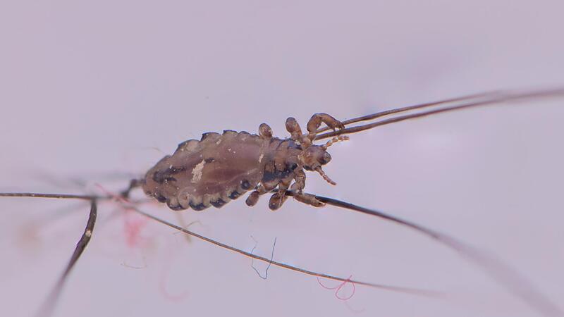 Kopflaus unter dem Mikroskop