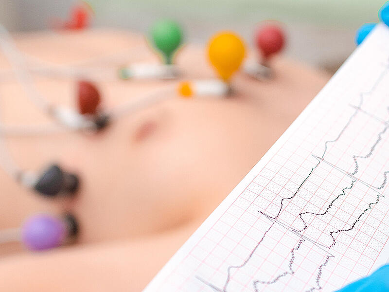 Ein EKG gibt Aufschluss über den Zustand des Herzens. Herzinfarkte waren Thema bei den Universitätstagen in Herzogenaurach.