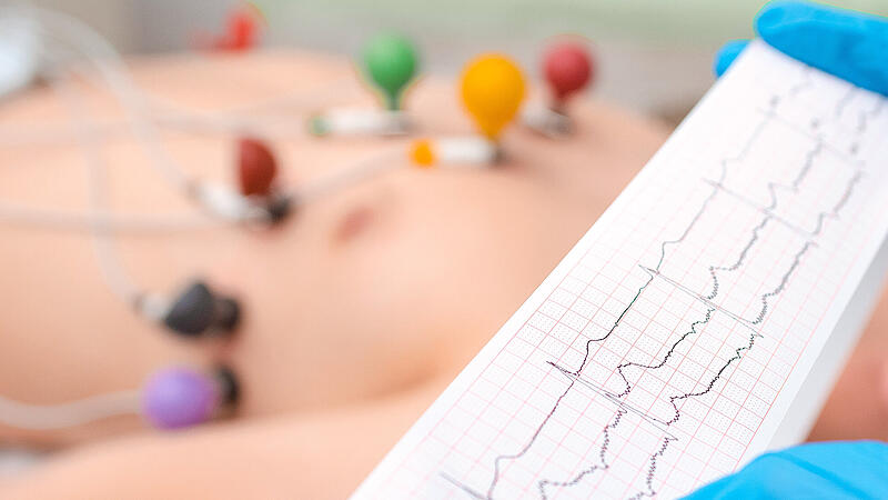 Ein EKG gibt Aufschluss über den Zustand des Herzens. Herzinfarkte waren Thema bei den Universitätstagen in Herzogenaurach.