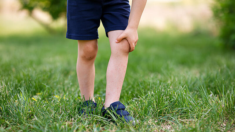 Anonymous Child Scratching Itchy Skin Irritation on Legs After Playing on Green Grass