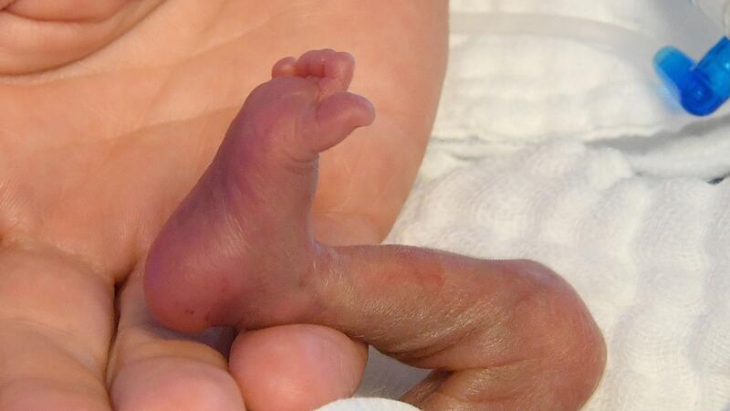 Fr&uuml;hgeborenes braucht Hautkontakt